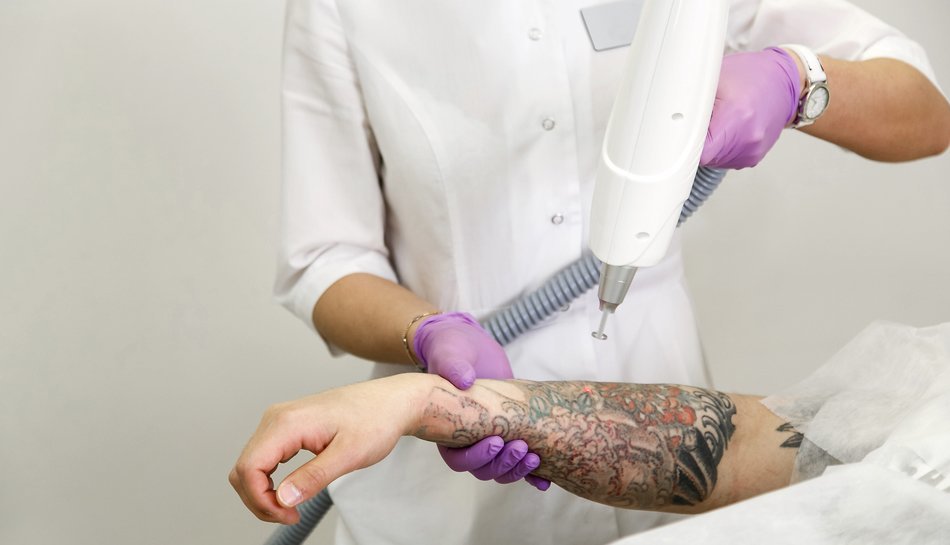 613 Tattoo Removal Laser Stock Photos - Free & Royalty-Free Stock Photos  from Dreamstime