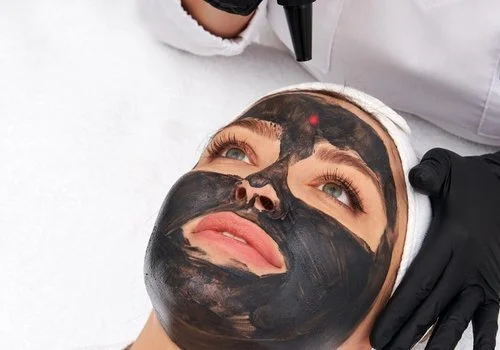 Carbon Laser Peel (Carbon Toning)